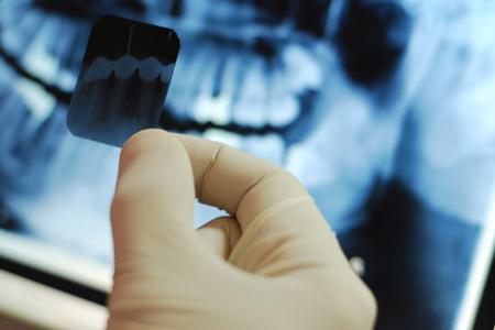 Рентгенология в стоматологии